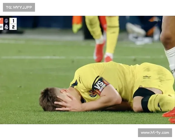 姆巴佩手指骨折缺阵皇马关键战，替补席观战面露凝重